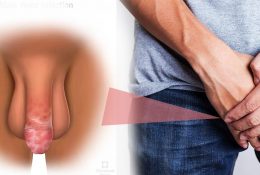 ngua-vung-da-bao-quy-dau-canh-bao-nhieu-benh-ly-khong-nen-coi-thuong