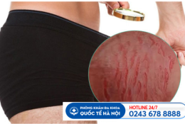 kho-nut-duong-vat-la-dau-hieu-cua-benh-ly-da-lieu-duong-vat