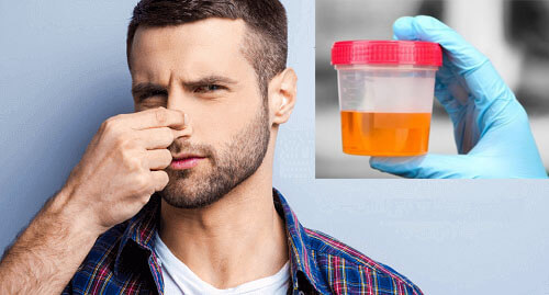 Đi Tiểu Nặng Mùi Kèm Buốt Rát – Khi Nào Cần Đi Khám?