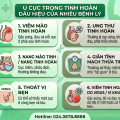 Sờ Thấy U Cục Trong Tinh Hoàn Là Bị Gì? Bác Sĩ Giải Đáp Từ A – Z