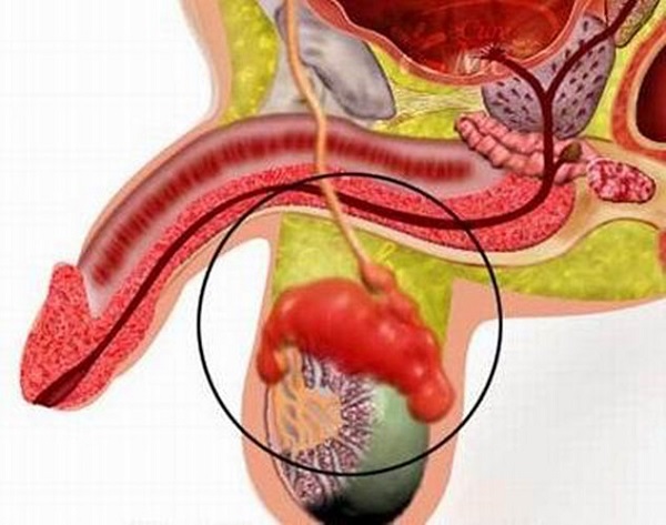 Các Bệnh Tinh Hoàn Thường Gặp Ở Nam Giới: Dấu Hiệu Và Cách Nhận Biết Sớm